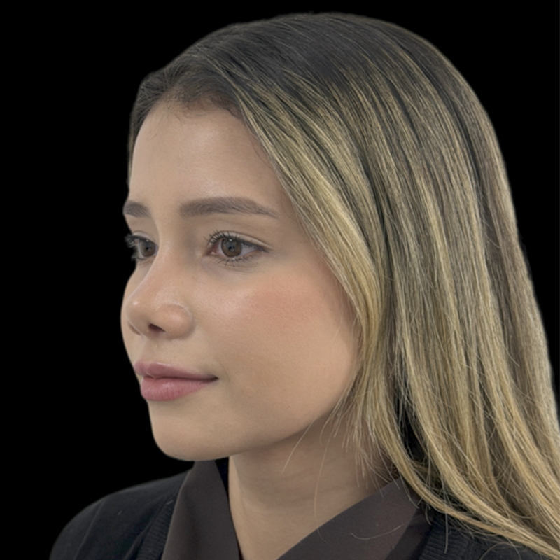 rino1_0000_rino-(1)