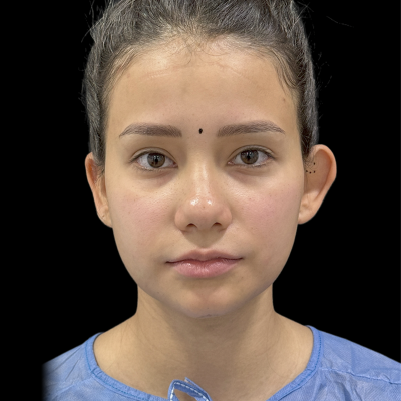 rino1_0001_rino-(4)