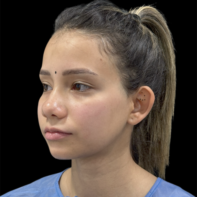 rino1_0002_rino-(3)