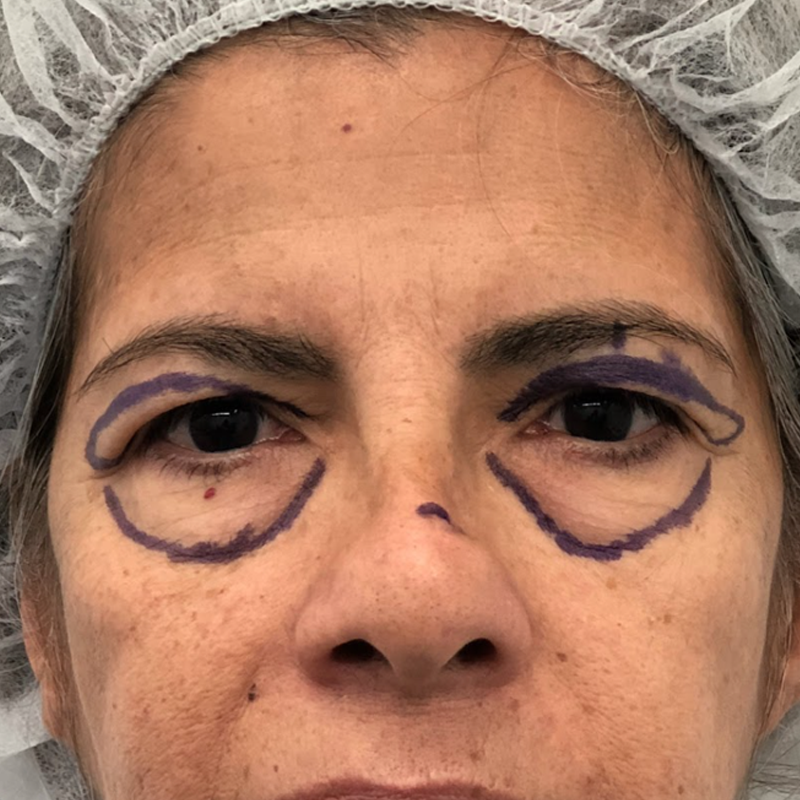 cejas-2 cejas-2