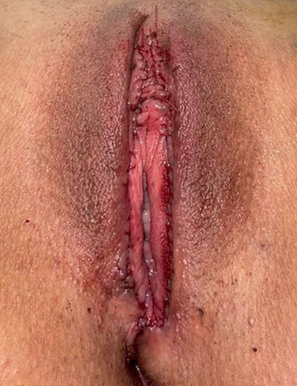 intima (1)