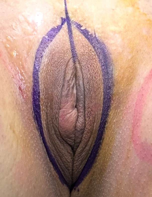 intima (4)