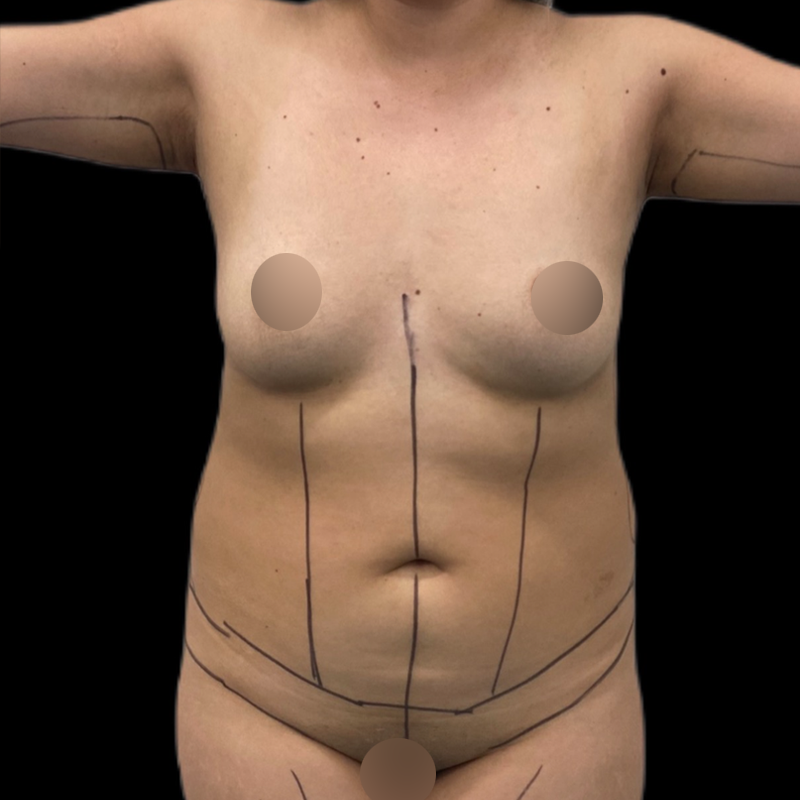 lipo4